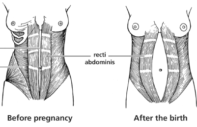 flatter stomach after pregnancy