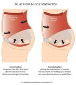 PFM contraction with title 158x175 - pelvic floor